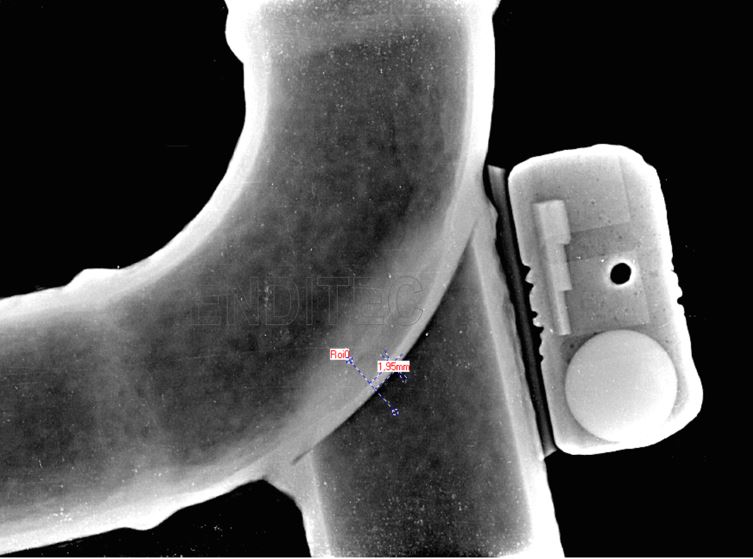 Detección de bajo espesor en codo inaccesible para ultrasonido